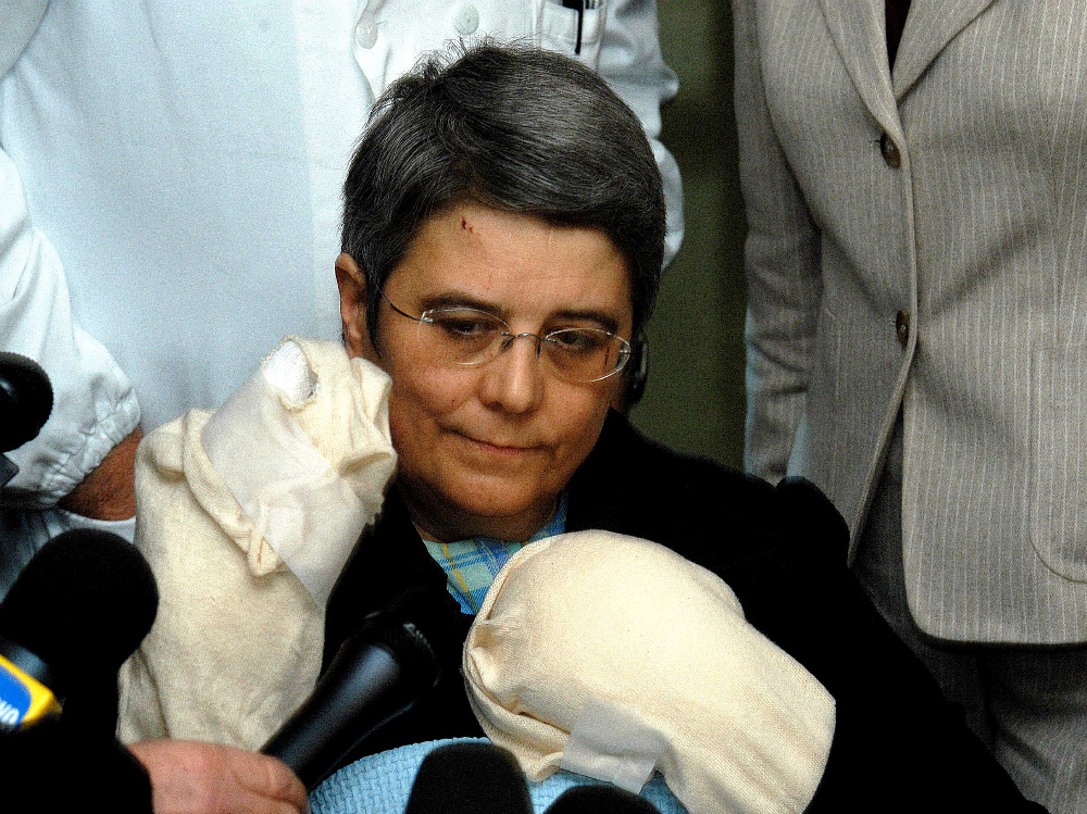 Il sindaco Stella poco tempo dopo l’attentato che le procurò serie ferite alle mani e alle braccia. ARCHIVIO 